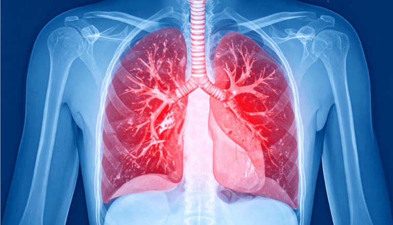 Silent Invisible Killer: Lungs Health, AQI, Indoor Pollution, and Vaping Realities